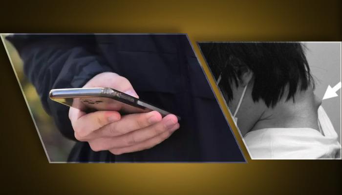 25 yaşındaki gencin boynu yamuldu! Sürekli telefon kullanımı boynunda ağır hasar oluşturdu: Düşük kafa sendromu ile Tıp literatürüne girdi…